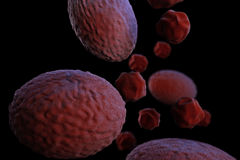 Urinary Tract Infection (UTI)